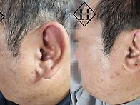 김포두피문신 잘하는곳 가..