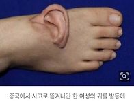 移植이 一般化됨