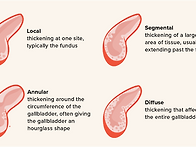 Diffuse aden..