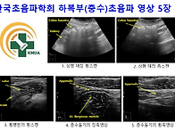 하복부_충수 기본..