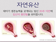 오병깨치 "임신확률은 높이..
