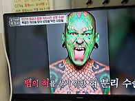 우리 곁에 다가 온 성형 ..