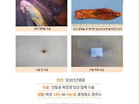 담낭선근종증수술후기. 폭..