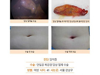 담석증수술후기. 이번 수술..