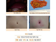 담낭염수술후기. 수술 진행..
