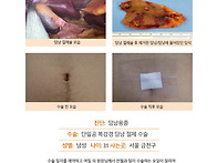 담낭용종수술후기. 건강검..