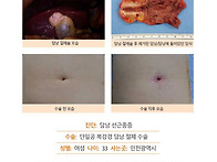 담낭선근종증수술후기. 단..