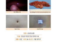 급성담낭염수술후기. 수술..