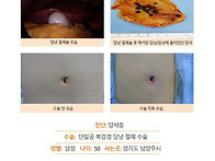 담석증수술후기. 수술은 ..
