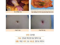 담석증수술후기. 유튜브 ..