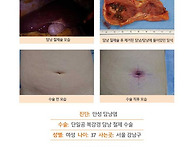 만성담낭염수술후기. 진료..