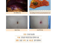 만성담낭염수술후기. 당일..
