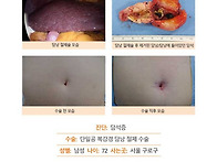 담석증수술후기. 김정윤 ..