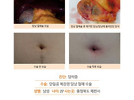 담석증수술후기. 수술시간..