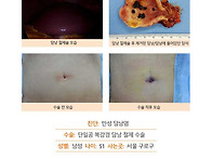 만성담낭염수술후기. 수술..