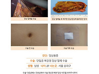 담낭용종수술후기. 수술해..