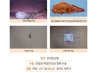 만성담낭염수술후기. 검사..