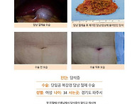 담석증수술후기. 선생님께..
