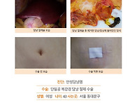 만성담낭염수술후기. 담낭..