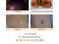 만성담낭염수술후기. 진료..