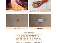 만성담낭염수술후기. 오랫..