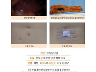 만성담낭염수술후기. 무엇..