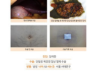 담석증수술후기. 가장 중요..