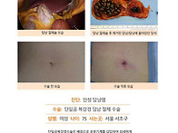 만성담낭염수술후기. 정윤..
