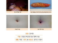 담석증수술후기. 김정윤 ..