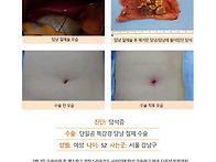담석증수술후기. 수술 담당..