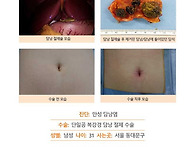 만성담낭염수술후기. 처음..