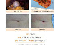 담석증수술후기. 원장님 ..