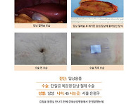 담낭용종수술후기. 혹시 ..