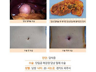 담석증수술후기. 김정윤 ..