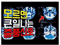 중풍 예방법