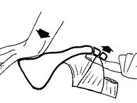 꼬리뼈 통증 / 미골통 /..