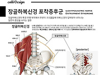 장골하복신경 포착..