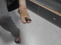 발가락 무좀관리를 시작합니다.