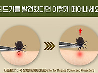 진드기
