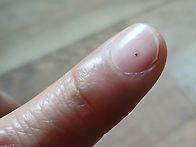 명자가시에 찔리다