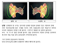 난청 더 이상 미루..