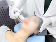 울쎄라 리프팅 300샷
