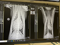 이오 수술 잘하고..