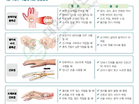 수공구 작업에 의..