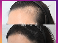 [30대 여자 갸름한 얼굴 ..