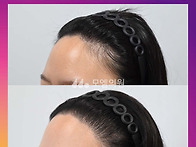 [30대 여자 안 예쁜 비대..
