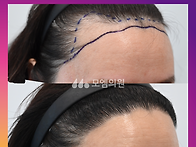 [40대 여자 넓은이마 헤어..