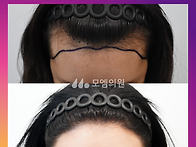 [30대 여자 넓은이마 헤어..