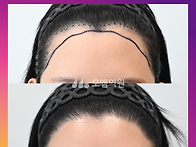 [20대 여자 안 예쁜 헤어..