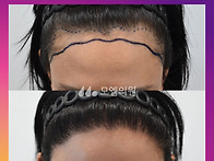 [30대 여자 M자 비대칭 헤..